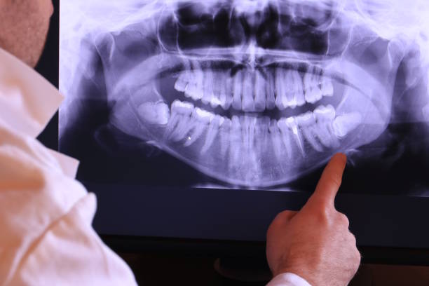 Best Emergency Root Canal Therapy in Orcutt, CA