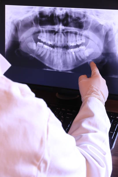Best Emergency Wisdom Tooth Extraction in Orcutt, CA