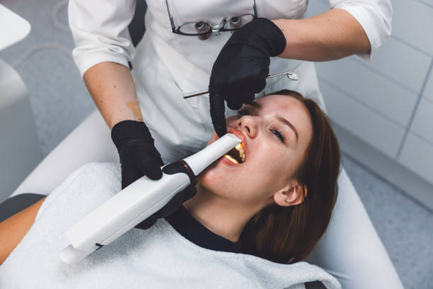 Best Knocked-Out Tooth (Avulsed Tooth) Treatment in Orcutt, CA
